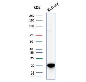 CRYAB Antibody Renal Tissue WB. Western blot analysis of Alpha B crystallin / CRYAB in human kidney tissue lysate using mouse monoclonal CRYAB antibody, clone CRYAB/4665. A band is detected at approximately 20 kDa, consistent with the predicted molecular weight of CRYAB, supporting detection of this small heat shock protein involved in molecular chaperone function and protein stabilization in renal tissue.