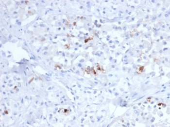 FSHB Antibody Sparse Gonadotroph IHC. Immunohistochemistry staining of FFPE human pituitary tissue using monoclonal clone FSHB/6845 demonstrates scattered granular cytoplasmic HRP-DAB brown staining within discrete endocrine cell populations, consistent with selective Follicle stimulating hormone beta / FSHB expression in gonadotroph-associated anterior pituitary cells. The focal staining distribution reflects the specialized hormone-producing nature of FSHB-positive endocrine compartments. HIER: boil tissue sections in pH 9 10mM Tris with 1mM EDTA for 20 min and allow to cool before testing.
