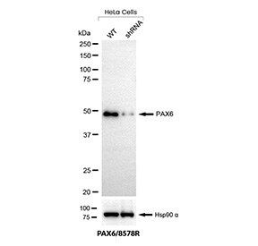 PAX6 Antibody Knockdown Validation WB. Western blot analysis of PAX6 expression in wild-type (WT) and PAX6 shRNA knockdown HeLa cells using PAX6 antibody clone PAX6/8578R. Lane 1: WT lysate, Lane 2: shRNA knockdown lysate. The band at approximately 45-50 kDa is reduced in knockdown cells, supporting target-specific detection. Hsp90 alpha is shown as a loading control.