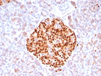 PAX6 Antibody Pancreatic Islet IHC. Immunohistochemistry analysis of Paired box protein Pax-6 (PAX6) in formalin-fixed, paraffin-embedded human pancreas tissue using PAX6 antibody clone PAX6/8578R. Strong nuclear HRP-DAB brown staining highlights endocrine cells within pancreatic islets, while surrounding exocrine tissue shows minimal signal, consistent with known PAX6 expression patterns. HIER: boil tissue sections in pH 9 10 mM Tris with 1 mM EDTA for 20 min followed by cooling before testing.
