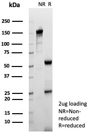 SDS-PAGE analysis of purified, BSA-free TPH1 antibody (clone TPH1/7661) as confirmation of integrity and purity.