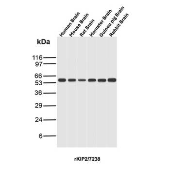 p57Kip2 Antibody Multi-Species Brain WB. Western blot analysis of p57Kip2 / CDKN1C expression across brain lysates from multiple species using p57Kip2 antibody clone rKIP2/7238. Lane 1: human brain lysate, Lane 2: mouse brain lysate, Lane 3: rat brain lysate, Lane 4: hamster brain lysate, Lane 5: guinea pig brain lysate, Lane 6: rabbit brain lysate. A band is detected at approximately 55-60 kDa, consistent with the predicted molecular weight of p57Kip2 (CDKN1C), a cyclin-dependent kinase inhibitor involved in growth control and differentiation. The consistent signal across species supports the use of this clone for cross-species brain reactivity studies.