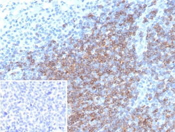 CD5 Antibody for IHC. Immunohistochemistry analysis of CD5 antibody staining in FFPE human tonsil tissue using a lymphoid malignancy marker antibody, clone rC5/6976. Strong membranous staining is observed in interfollicular T lymphocytes with dense labeling of T cell zones surrounding germinal centers, while follicular B cell regions remain largely negative. The staining pattern highlights normal tonsillar architecture and reflects the relevance of CD5 in identifying lymphocyte populations associated with lymphoid malignancy and immune cell lineage analysis. Inset: PBS used in place of primary antibody shows no specific staining, confirming secondary antibody specificity. Heat-induced epitope retrieval was performed using pH 9 Tris-EDTA buffer for 20 minutes followed by cooling prior to antibody incubation.
