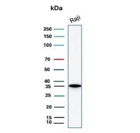 Western blot testing of human Raji cell lysate with CD20 antibody. Predicted molecular weight ~33 kDa.