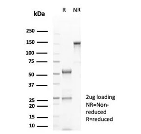 SDS-PAGE analysis of purified, BSA-free CD20 antibody (clone rMS4A1/8044) as confirmation of integrity and purity.