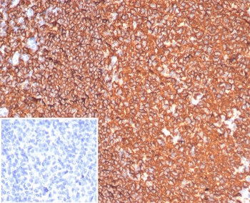 Immunohistochemistry analysis of CD20 Antibody Recombinant Rabbit MAb in human tonsil tissue. FFPE human tonsil demonstrates strong membranous HRP-DAB brown staining in B lymphocytes within germinal centers and follicular regions, consistent with CD20/MS4A1 surface expression, while surrounding T-cell zones show minimal staining. The inset image shows the PBS negative control with no specific signal. Antigen retrieval was performed by boiling tissue sections in pH 9 10mM Tris with 1mM EDTA for 20 minutes followed by cooling prior to incubation with CD20 antibody (clone MS4A1/6993R).