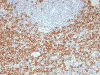CD5 Antibody for IHC. Immunohistochemistry analysis of CD5 antibody staining in FFPE human tonsil tissue using an adaptive immune response marker antibody, clone C5/8117R. Strong membranous staining is observed in interfollicular T lymphocytes with dense labeling of T cell zones surrounding germinal centers, while follicular B cell regions remain largely negative. The staining pattern highlights normal tonsillar architecture and reflects the role of CD5 in antigen-driven adaptive immune responses within lymphoid tissue. Heat-induced epitope retrieval was performed using pH 9 Tris-EDTA buffer for 20 minutes followed by cooling prior to antibody incubation.