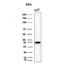 Western blot testing of human Raji cell lysate with recombinant CD20 antibody (clone MS4A1/8072R). Predicted molecular weight ~33 kDa.