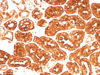 Ferritin Heavy Chain Antibody Kidney IHC. Immunohistochemistry staining of FFPE human kidney tissue using Ferritin Heavy Chain Antibody / Iron Storage Protein Antibody clone FTH/8700R demonstrates strong granular cytoplasmic HRP-DAB brown staining throughout renal tubular epithelial cells, consistent with Ferritin Heavy Chain / FTH1 expression in metabolically active nephron-associated compartments involved in intracellular iron storage, ferroxidase activity, and oxidative stress regulation. HIER: boil tissue sections in pH 9 10mM Tris with 1mM EDTA for 20 min and allow to cool before testing.