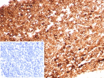 Ferritin Heavy Chain Antibody Tonsil IHC. Immunohistochemistry staining of FFPE human tonsil tissue using Ferritin Heavy Chain Antibody / Iron Storage Protein Antibody clone FTH/8700R demonstrates widespread granular cytoplasmic HRP-DAB brown staining within lymphoid-associated cellular populations, supporting expression of Ferritin Heavy Chain / FTH1 in immune tissue compartments linked to intracellular iron handling and oxidative stress-associated metabolic pathways. Inset: PBS used in place of primary antibody as a negative control demonstrates minimal background staining. HIER: boil tissue sections in pH 9 10mM Tris with 1mM EDTA for 20 min and allow to cool before testing.