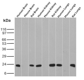 Ferritin Heavy Chain Antibody Multi-Species WB. Western blot analysis of human, mouse, and rat brain, kidney, and lung tissue lysates using recombinant monoclonal clone FTH/8700R demonstrates distinct bands near 20-24 kDa corresponding to Ferritin heavy chain / FTH1 across multiple organs and species. The broad tissue distribution supports the conserved role of FTH1 in intracellular iron storage, ferroxidase activity, and protection against oxidative stress-associated cellular injury in metabolically active tissues.