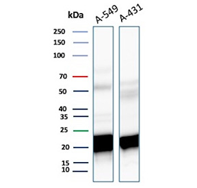 Ferritin Heavy Chain Antibody Carcinoma WB. Western blot analysis of human A-549 and A-431 cell lysates using recombinant monoclonal clone FTH/8700R demonstrates prominent bands near 20-24 kDa corresponding to Ferritin heavy chain / FTH1, with additional faint higher molecular weight species potentially representing ferritin complex-associated or partially denatured protein forms. The observed expression profile supports the role of FTH1 in intracellular iron sequestration, oxidative stress buffering, and metabolic regulation within epithelial carcinoma-derived cell lines.