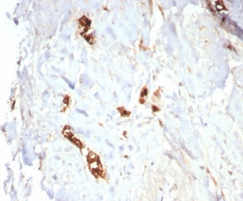 Mammaglobin Antibody Recombinant Rabbit MAb MGB/7980R immunohistochemistry of human lactating breast tissue. FFPE human lactating breast tissue was stained with Mammaglobin Antibody Recombinant Rabbit MAb MGB/7980R. HRP-DAB brown chromogenic signal highlights cytoplasmic staining in secretory epithelial cells of mammary glandular structures, consistent with expression of Mammaglobin A / SCGB2A2 in lactating breast epithelium, while surrounding stromal cells show minimal staining. Heat-induced epitope retrieval was performed by boiling tissue sections in pH 9 10mM Tris with 1mM EDTA for 20 minutes followed by cooling prior to staining.