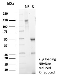 SDS-PAGE analysis of purified, BSA-free recombinant Mammaglobin antibody MGB/7980R as confirmation of integrity and purity.