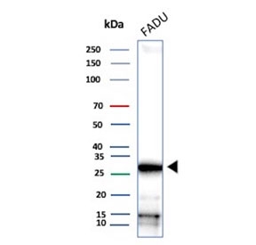 Western blot testing of human FADU cell lysate with NC2 alpha antibody. Predicted molecular weight ~22 kDa, commonly observed at 26-30 kDa.