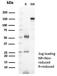 SDS-PAGE analysis of purified, BSA-free PR/Progesterone Receptor antibody (PGR/8099R) as confirmation of integrity and purity.