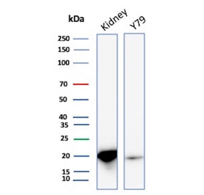Western blot testing of human kidney and Y79 cell lysate with Crystallin Alpha B antibody (clone CRYAB/4661). Predicted molecular weight ~20 kDa.