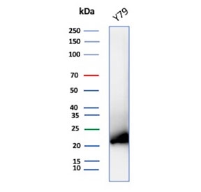 Western blot testing of human Y79 cell lysate with Crystallin Alpha B antibody (clone CRYAB/7918).