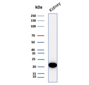 Western blot testing of human kidney tissue lysate with Crystallin Alpha B antibody (clone CRYAB/4666). Predicted molecular weight ~20 kDa.