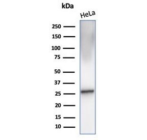 CRYAB Antibody HeLa WB. Western blot analysis of Alpha B crystallin / CRYAB in human HeLa cell lysate using mouse monoclonal CRYAB antibody, clone CRYAB/4657. A band is detected at approximately 20 kDa, consistent with the predicted molecular weight of CRYAB, supporting detection of this small heat shock protein in epithelial-derived cells.