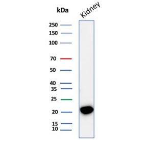 Western blot testing of human kidney tissue lysate with CRYAB antibody (clone CRYAB/4662). Predicted molecular weight ~20 kDa.