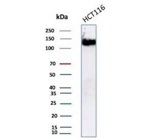 CD56 Antibody Recombinant Rabbit MAb NCAM1/8392R. Western blot analysis of human HCT-116 cell lysate demonstrates a strong band cluster between approximately 120-180 kDa corresponding to Neural cell adhesion molecule 1 (NCAM1), also known as CD56. These bands are consistent with the major transmembrane NCAM isoforms commonly detected in mammalian cells. Additional signal near approximately 110 kDa may represent a soluble or processed NCAM fragment. The band pattern reflects the presence of multiple NCAM1 isoforms and the heavily glycosylated nature of this cell adhesion molecule.