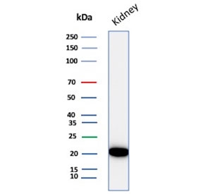 CRYAB Antibody Renal Tissue WB. Western blot analysis of Alpha B crystallin / CRYAB in human kidney tissue lysate using mouse monoclonal CRYAB antibody, clone CRYAB/4659. A band is detected at approximately 20 kDa, consistent with the predicted molecular weight of CRYAB, supporting detection of this small heat shock protein in renal tissue under physiological conditions.