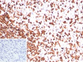 CD3e Antibody. Immunohistochemistry analysis of CD3 Epsilon / CD3E antibody in FFPE human spleen tissue using CD3e Antibody / Pan T Cell Lineage Marker Antibody with Clone rC3e/8881. Strong HRP-DAB brown membranous and cytoplasmic staining is observed in T lymphocytes distributed throughout the white pulp and periarteriolar lymphoid sheath regions, consistent with T-cell lineage localization, while surrounding non-lymphoid cells show minimal background. The inset shows the negative control with PBS used in place of the primary antibody, demonstrating absence of non-specific staining. Heat-induced epitope retrieval was performed by boiling tissue sections in pH 9 10 mM Tris with 1 mM EDTA for 20 minutes followed by cooling prior to antibody incubation.