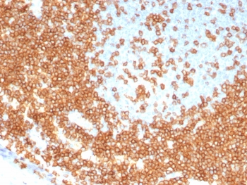 CD3 epsilon Antibody Recombinant Rabbit Monoclonal. Immunohistochemistry analysis of CD3 Epsilon / CD3E antibody in FFPE human tonsil tissue using CD3 epsilon Antibody Recombinant Rabbit Monoclonal Clone C3e/8115R. Strong HRP-DAB brown membranous and cytoplasmic staining is observed in T lymphocytes within interfollicular and paracortical regions, consistent with T-cell zone distribution, while surrounding non-lymphoid cells show minimal background. The staining highlights dense T-cell populations within lymphoid architecture and demonstrates clear signal definition with low non-specific staining. Heat-induced epitope retrieval was performed by boiling tissue sections in pH 9 10 mM Tris with 1 mM EDTA for 20 minutes followed by cooling prior to antibody incubation.
