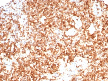 CD3G Antibody Human Lymph Node IHC. Immunohistochemical staining of FFPE human lymph node tissue with CD3G / CD3beta1 antibody (clone CD3G/8794). Heat-induced epitope retrieval (HIER) was performed by boiling tissue sections in pH 9, 10 mM Tris with 1 mM EDTA for 20 minutes and allowing them to cool prior to staining. CD3G immunoreactivity is observed predominantly along the cell membranes and within the cytoplasm of lymphocytes, consistent with the expected localization of this T-cell receptor complex protein involved in antigen recognition and T-cell activation. Cell nuclei are counterstained with hematoxylin (blue).