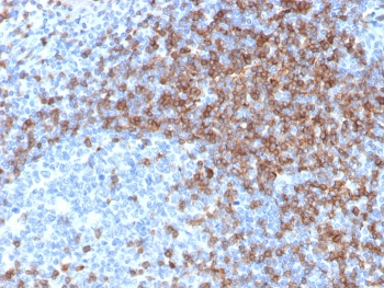 CD3 epsilon Antibody Immunohistochemistry. Analysis of CD3 Epsilon / CD3E staining in FFPE human tonsil tissue using CD3 epsilon Antibody / Pan T Cell Lineage Marker Antibody with Clone rC3e/6966. Strong HRP-DAB brown membranous and cytoplasmic staining is observed in T lymphocytes concentrated within interfollicular and paracortical regions, while germinal center areas show reduced staining, consistent with pan T-cell lineage distribution. The staining pattern highlights the organization of CD3-positive lymphocytes within tonsillar lymphoid architecture. Heat-induced epitope retrieval was performed by boiling tissue sections in pH 9 10 mM Tris with 1 mM EDTA for 20 minutes followed by cooling prior to antibody incubation.
