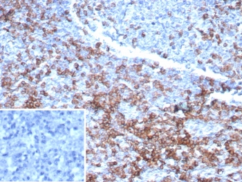 CD3e Antibody Recombinant Mouse Monoclonal. Immunohistochemistry analysis of CD3 Epsilon / CD3E antibody in FFPE human lymph node tissue using CD3e Antibody Recombinant Mouse Monoclonal Clone rC3e/6967. Strong HRP-DAB brown membranous and cytoplasmic staining is observed in T lymphocytes within paracortical regions, consistent with T-cell zone localization, while surrounding non-lymphoid cells show minimal background. The inset shows the negative control with PBS used in place of the primary antibody, demonstrating absence of non-specific staining. Heat-induced epitope retrieval was performed by boiling tissue sections in pH 9 10 mM Tris with 1 mM EDTA for 20 minutes followed by cooling prior to antibody incubation.