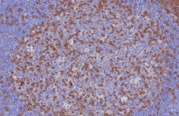CD3e Antibody. Immunohistochemistry analysis of CD3 Epsilon / CD3E antibody in FFPE human tonsil tissue using CD3e Antibody / T Cell Activation Marker Antibody with Clone C3e/8116R. Strong HRP-DAB brown membranous and cytoplasmic staining is observed in T lymphocytes within interfollicular and paracortical regions, consistent with activated T-cell distribution, while surrounding non-lymphoid cells show minimal background. The staining highlights CD3 epsilon as a key mediator of T cell activation within lymphoid tissue architecture. Heat-induced epitope retrieval was performed by boiling tissue sections in pH 9 10 mM Tris with 1 mM EDTA for 20 minutes followed by cooling prior to antibody incubation.