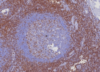 CD3e Antibody. Immunohistochemistry analysis of CD3 Epsilon / CD3E antibody in FFPE human tonsil tissue using CD3e Antibody / T Cell Activation Marker Antibody with Clone C3e/8116R. Strong HRP-DAB brown membranous and cytoplasmic staining is observed in T lymphocytes surrounding and within interfollicular regions adjacent to germinal centers, consistent with activated T-cell distribution, while germinal center B-cell regions show reduced staining. The staining highlights CD3 epsilon as a key mediator of T cell activation within lymphoid architecture. Heat-induced epitope retrieval was performed by boiling tissue sections in pH 9 10 mM Tris with 1 mM EDTA for 20 minutes followed by cooling prior to antibody incubation.
