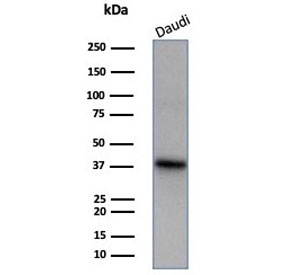 FLI1 Antibody Human Daudi Cell WB. Western blot testing of human Daudi cell lysate with Fli1 antibody (clone FLI1/7508). Predicted molecular weight ~50 kDa.
