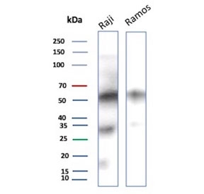 CD27 Antibody for WB. Western blot analysis of CD27 / TNFRSF7 expression in human B-cell lymphoma cell lines using CD27 Antibody / Tumor Immune Microenvironment Marker Antibody. Lane 1: Raji cell lysate, Lane 2: Ramos cell lysate. A band is detected at approximately 50â60 kDa, consistent with glycosylated CD27, noting a lower predicted molecular weight of approximately 29 kDa for the core protein. Additional lower molecular weight signal may represent unmodified or partially processed forms of CD27. Detection of CD27 in Raji and Ramos cells aligns with expression in B-cell lineage populations relevant to tumor-associated immune environments.