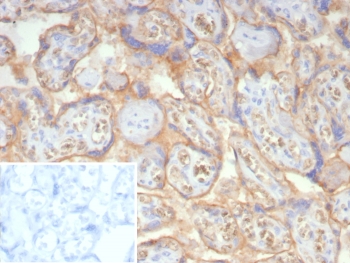 NSE Antibody Human Placenta IHC. Immunohistochemistry staining of FFPE human placental tissue with NSE gamma antibody (clone ENO2/7447). Inset: PBS used in place of primary Ab (secondary Ab negative control). HIER: boil tissue sections in pH 9 10mM Tris with 1mM EDTA for 20 min and allow to cool before testing.