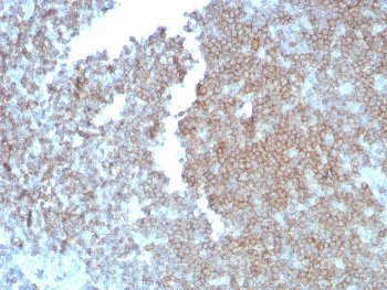 CD27 Antibody for Human LN IHC. Immunohistochemistry analysis of CD27 / TNFRSF7 expression in FFPE human lymph node tissue using CD27 Antibody / Immune Checkpoint Pathway Antibody clone LPFS2/8838R. Prominent membranous HRP-DAB brown staining is observed in lymphocyte populations within follicular and paracortical regions, consistent with CD27 expression on activated and regulatory T and B cell subsets involved in immune signaling, while surrounding stromal elements remain largely negative. The staining pattern highlights immune regulatory compartments and supports evaluation of checkpoint-related signaling within lymphoid tissue architecture. Heat-induced epitope retrieval was performed in pH 9 10 mM Tris with 1 mM EDTA for 20 minutes followed by cooling prior to antibody incubation.