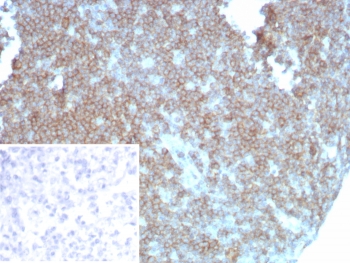 CD27 Antibody for Lymph Tissue IHC. Immunohistochemistry analysis of CD27 / TNFRSF7 expression in FFPE human lymph node tissue using CD27 Antibody / Immune Checkpoint Pathway Antibody clone LPFS2/8838R. Strong membranous HRP-DAB brown staining is observed in lymphocyte populations within follicular and paracortical regions, consistent with CD27 expression on activated and regulatory T and B cell subsets involved in immune signaling, while surrounding stromal elements remain largely negative. The staining pattern highlights immune regulatory compartments and supports evaluation of checkpoint-related signaling within lymphoid tissue architecture. Inset: PBS used in place of primary Ab (secondary Ab negative control). Heat-induced epitope retrieval was performed in pH 9 10 mM Tris with 1 mM EDTA for 20 minutes followed by cooling prior to antibody incubation.