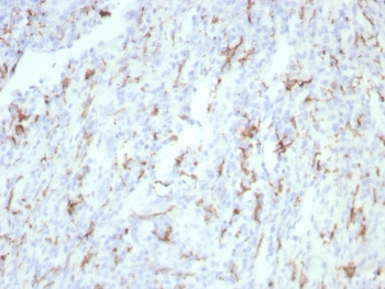 IHC staining of FFPE human tonsil tissue with CD163 antibody (clone rM130/8823). HIER: boil tissue sections in pH 9 10mM Tris with 1mM EDTA for 20 min and allow to cool before testing.