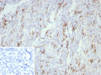 IHC staining of FFPE human tonsil tissue with CD163 antibody (clone rM130/8823). Inset: PBS used in place of primary Ab (secondary Ab negative control). HIER: boil tissue sections in pH 9 10mM Tris with 1mM EDTA for 20 min and allow to cool before testing.