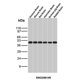 NSE Antibody Multi-Species Brain WB. Western blot analysis of brain tissue lysates from human, mouse, rat, hamster, guinea pig, and rabbit using NSE Antibody (clone ENO2/8614R) detects a band at the predicted molecular weight of approximately 47 kDa, consistent with neuron-specific enolase (ENO2) expression across multiple species, supporting its conserved role in neural tissue.
