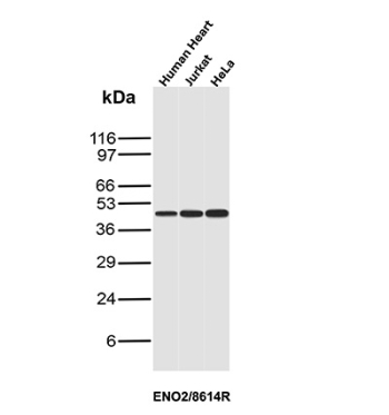 NSE Antibody Human Cell Line and Tissue WB. Western blot analysis of human heart, Jurkat, and HeLa cell lysates using NSE Antibody (clone ENO2/8614R) detects a band at the predicted molecular weight of approximately 47 kDa, consistent with neuron-specific enolase (ENO2) expression, with signal observed across multiple human sample types.