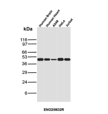 NSE Gamma Antibody Human Tissue and Cell Line WB. Western blot analysis of human brain, human heart, A549, HeLa, and Jurkat cell lysates using NSE Gamma Antibody (clone ENO/8632R) detects a band at the predicted molecular weight of approximately 47 kDa, consistent with gamma enolase (ENO2) expression across multiple human tissues and cell lines, supporting its use for broad detection across sample types.