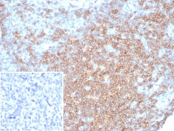 CD27 Antibody for Human Lymph Node Tissue IHC. Immunohistochemistry analysis of CD27 / TNFRSF7 expression in FFPE human lymph node tissue using CD27 Antibody / Lymphocyte Differentiation Marker Antibody clone LPFS2/8316R. Membranous HRP-DAB brown staining is observed in lymphocyte populations within follicular and paracortical regions, consistent with CD27 expression on antigen-experienced and differentiated T and B cells, while surrounding stromal elements remain largely negative. The staining pattern highlights lymphocyte maturation compartments and supports evaluation of differentiation states within lymphoid tissue architecture. Inset: PBS used in place of primary Ab (secondary Ab negative control). Heat-induced epitope retrieval was performed in pH 9 10 mM Tris with 1 mM EDTA for 20 minutes followed by cooling prior to antibody incubation.