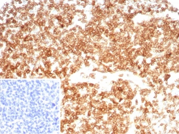 CD27 Antibody for IHC. Immunohistochemistry analysis of CD27 / TNFRSF7 expression in FFPE human tonsil tissue using CD27 Antibody / Immune Memory Formation Marker Antibody clone LPFS2/8607R. Strong membranous HRP-DAB brown staining is observed in lymphocyte populations within germinal centers and interfollicular regions, consistent with CD27 expression on memory T cells and memory B cells, while surrounding stromal elements remain largely negative. The staining pattern highlights immune memory compartments and supports evaluation of antigen-experienced lymphocyte populations within tonsillar tissue. Inset: PBS used in place of primary Ab (secondary Ab negative control). Heat-induced epitope retrieval was performed in pH 9 10 mM Tris with 1 mM EDTA for 20 minutes followed by cooling prior to antibody incubation.