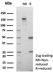 SDS-PAGE analysis of purified, BSA-free Alpha-2M antibody (clone A2M/6556) as confirmation of integrity and purity.