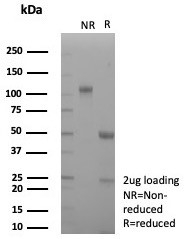 SDS-PAGE analysis of purified, BSA-free recombinant CD163 antibody (clone M130/8821R) as confirmation of integrity and purity.