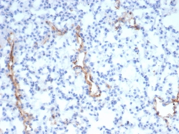 von Willebrand Factor Antibody / Platelet Adhesion Mediator Antibody. Immunohistochemistry analysis of mouse lung tissue shows HRP-DAB brown staining of endothelial cells lining vascular structures, including small vessels and capillary networks within the pulmonary parenchyma. The staining highlights vessel-associated endothelial surfaces where VWF is present, consistent with its role in mediating platelet adhesion along the vascular lining. Elongated and branching vascular profiles are clearly delineated from surrounding alveolar and interstitial cells. Clone VWF/4105 enables visualization of vascular endothelium in a pattern aligned with adhesive hemostatic function at the vessel interface. HIER: boil tissue sections in pH 9 10mM Tris with 1mM EDTA for 20 min and allow to cool before testing.