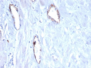 IHC staining of FFPE human uterus tissue with vWF/von Willebrand Factor antibody (clone VWF/4105). HIER: boil tissue sections in pH 9 10mM Tris with 1mM EDTA for 20 min and allow to cool before testing.